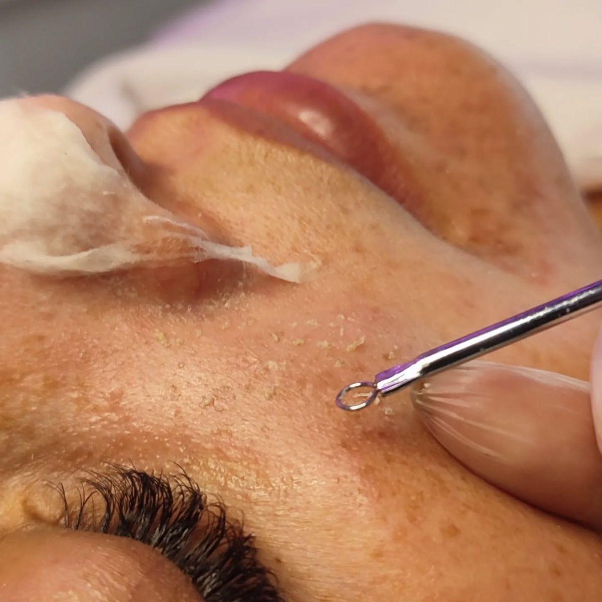 Limpieza Facial Clásica profunda